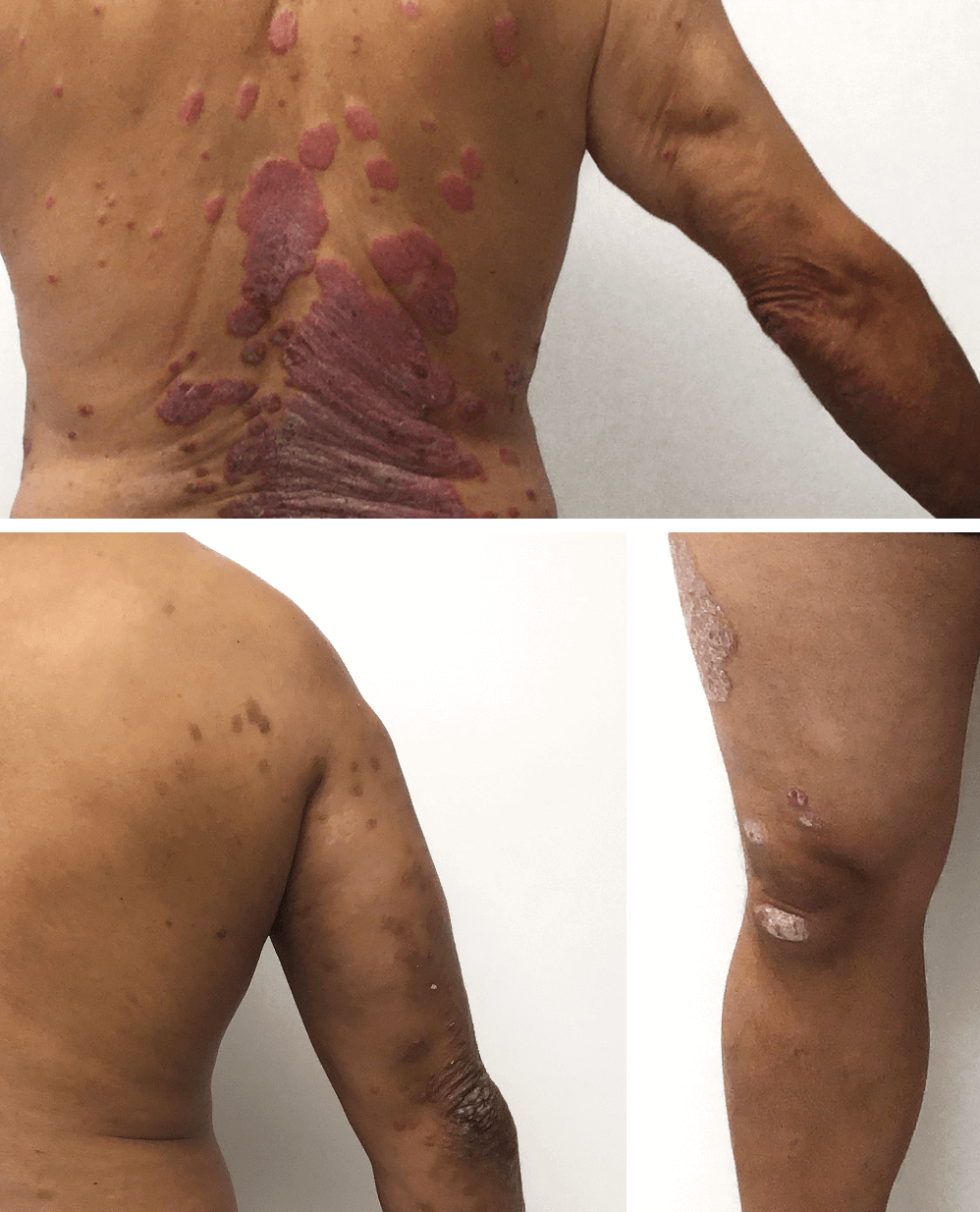 Deficiencia de nutrientes: ¿una causa oculta de los problemas de la pi –  DR.VEGAN, image size:998x1234